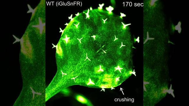 Glutamate triggers long-distance, calcium-based plant defense signaling