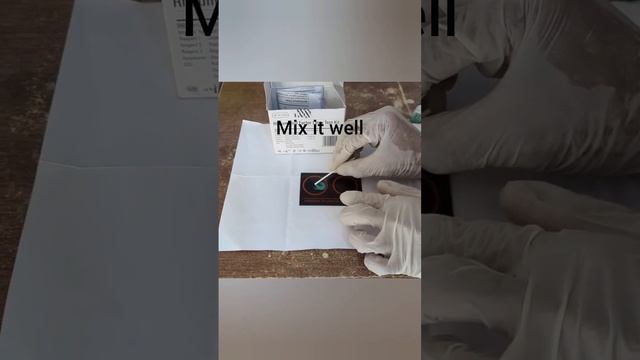 How To Do RA Test (Rhematoid Arthritis) By Latex Agglutination Method #RAfactor #pathology