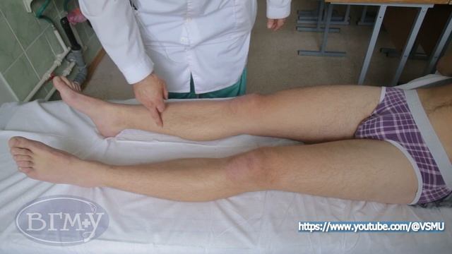 Проекция большой подкожной вены