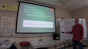 Clinical Rotation:  EKG Day Two: Rate, Sinus Rhythm - SVT