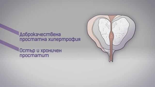 Proxelan - за здрава простата