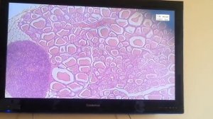 Гистология  Препарат  Щитовидная и околощитовидные железы  Окраска  Гематоксилин