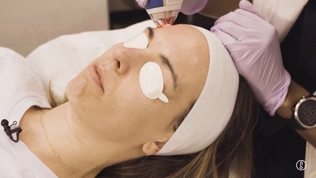 Learn From a Derm: How to Treat and Prevent Melasma