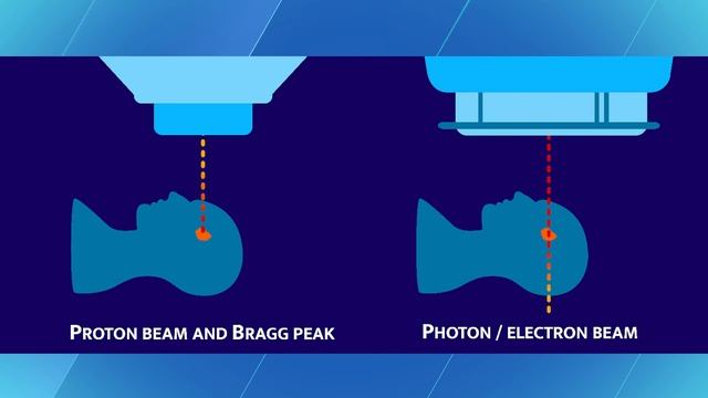 The Science Behind Proton Therapy