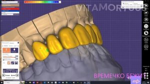 EXOCAD 10 MIN CHAllENGE MODELING ЭКЗОКАД 10 МИНУТ ЧЕЛЕНЖ МОДЕЛИРОВКА зубные техники стоматология СП