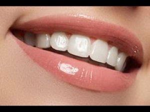 Красивейшие в мире зубы.