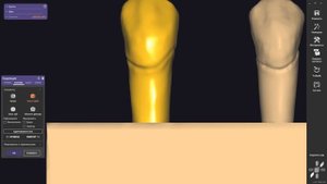 Exocad Carving I Tooth Modeling 19