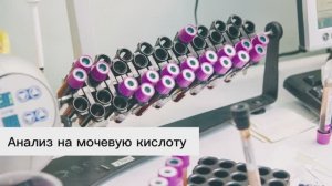 Анализ на мочевую кислоту