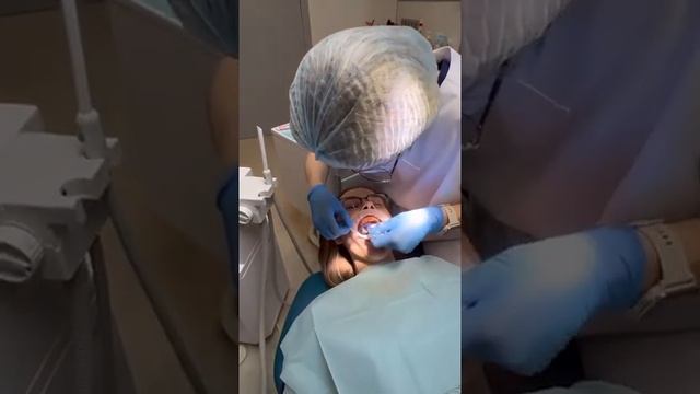 Снятие слепков под коронки на имплантаты.