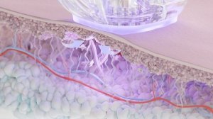 Smart ВАКУУМНЫЙ RF (РФ) ЛИФТИНГ КОЖИ ELLISYS SENSE

Источник: https://www.telosbeauty.ru/services/v