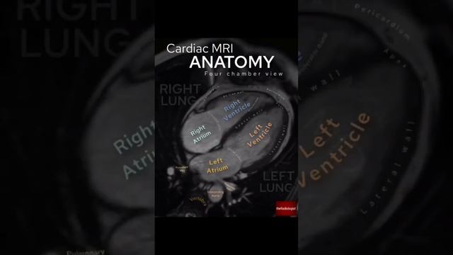 Cardiac MRI Anatomy