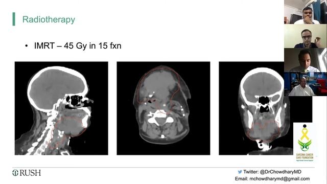 HIGHLIGHTS OF WEBINAR- PROTON THERAPY AND SARCOMA CASE STUDY 2: Dr MUDIT CHOUDHARY