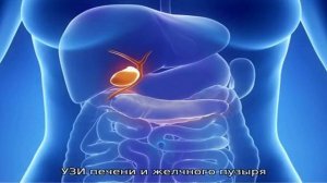 Хронический калькулезный холецистит