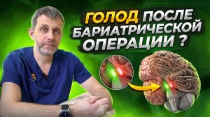 ГРЕЛИН. ЧУВСТВО ГОЛОДА после бариатрической операции  ЧТО ДЕЛАТЬ Ответ бариатрического хирурга