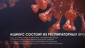 Крупозная пневмония определение