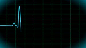 кардиограмма