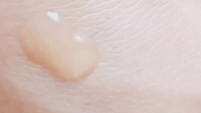 Best Anti Aging Serum// Serum For Oily Skin @Selfglam-dj6oz #oilyskin #serum  #retinol