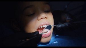 Что делать после удаления зуба | 10 самых важных советов после удаления зуба