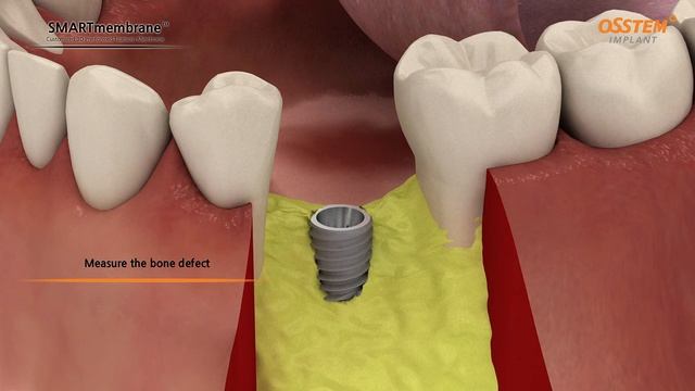 Мембрана SMARTbuilder смотреть онлайн