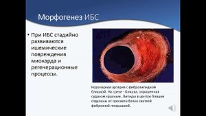 Болезни сердца.