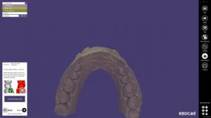 Exocad VALLETTA 2.2 Jaw Motion Import