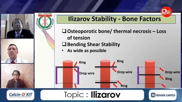 Orthopaedic Solution Academy - Prof M Bari - Ilizarov -Ep 1- Methodology past present future -Raj T