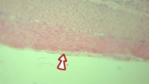Разбор гистологического препарата: Толстая кишка. Г.Э.