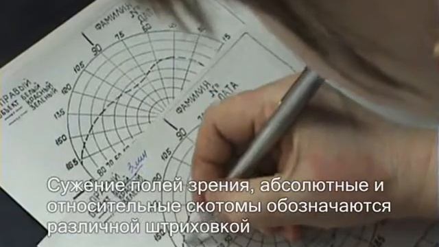 Периметрия
