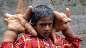 5 АНОМАЛЬНЫХ ДЕТЕЙ, КОТОРЫЕ РЕАЛЬНО СУЩЕСТВУЮТ!