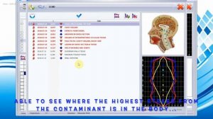 Sensitiv Imago (SI) Key Concepts: Assessment of Express Monitoring: Contaminants