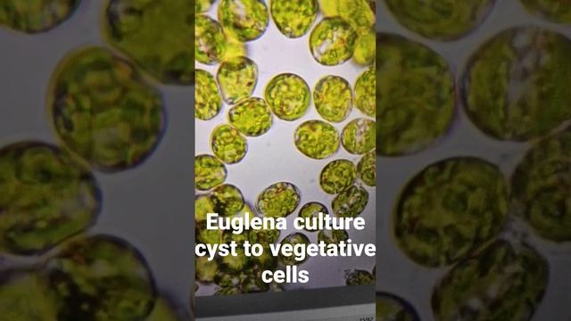 Euglena culture cyst to vegetative cells Microalgal culture under microscope. Microscopic view alga