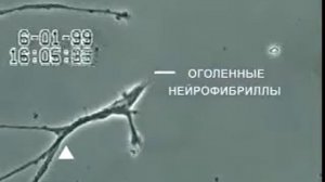 Ртуть и нейроны головного мозга