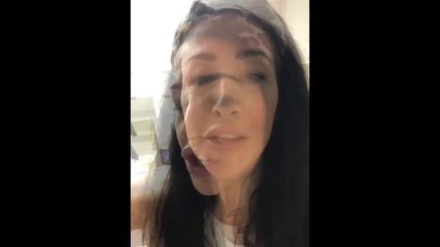Anti-Wrinkle Injections