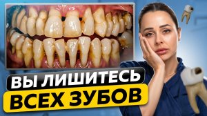 Как НЕ Потерять Зубы! РЕЦЕССИЯ ДЕСНЫ | Что делать, если опустилась десна?