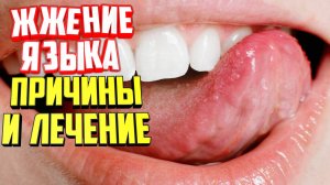 Жжение языка причины и лечение