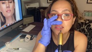 HYALURON PEN, lip filler- Refill TUTORIAL-result!