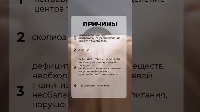Грыжа позвоночника краткий обзор #грыжалечение #грыжадиска #грыжапозвоночника #грыжа #грыжи