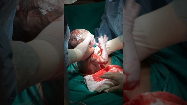 C-Section Quick Guide: Everything You Need to Know #maternalhealth #pregnancyexperience #baby