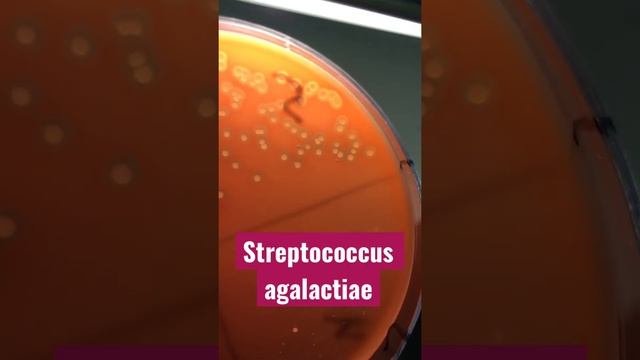 Streptococcus agalactiae - рост стрептококка с гемолизом на кровяном агаре