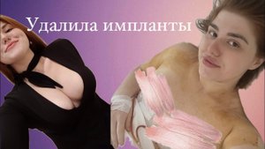 Увеличение груди | Болезнь грудных имплантов | УДАЛИЛА ИМПЛАНТЫ