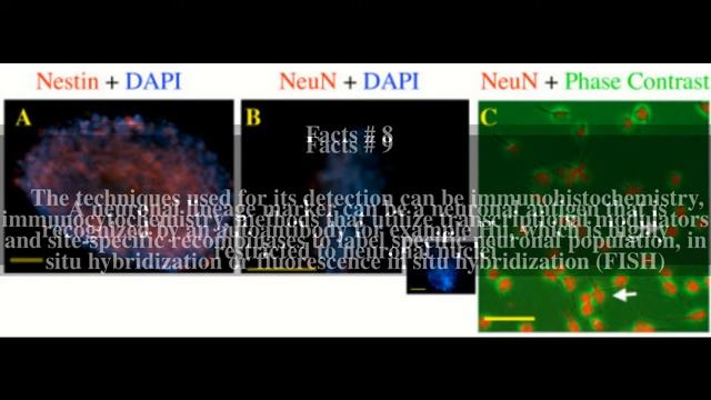 Neuronal lineage marker Top # 16 Facts смотреть онлайн