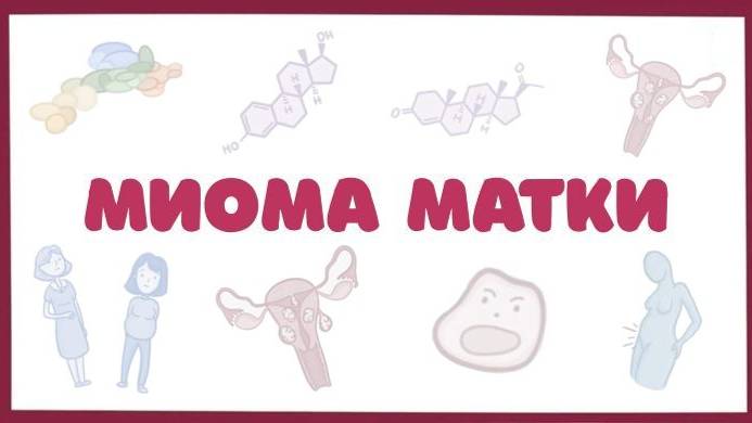 Миома матки - причины, симптомы, диагностика, лечение (гинекология) лекция