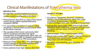 Hematology in 10 min: Polycythemia