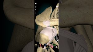 Соединения верхней конечности. Акромиально-ключичный сустав и грудинно-ключичный сустав. Анатомия