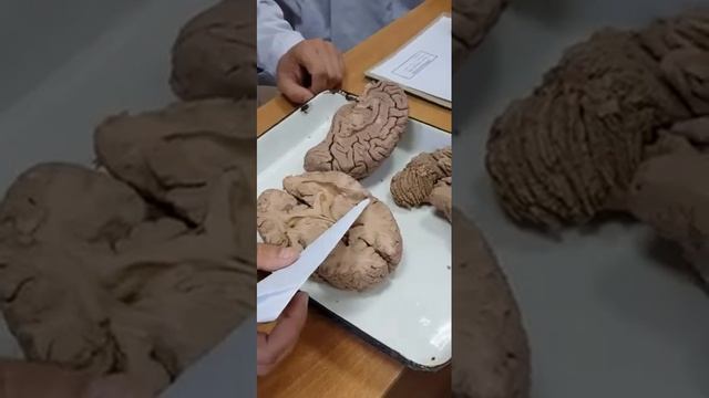 Cerebrum-3 смотреть онлайн