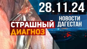 Страшный диагноз. Новости Дагестана за 28.11.2024 год