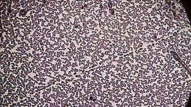 Area Hapusan Darah Secara Mikroskopik Lensa 10x 40x | Sebaran Sel darah смотреть онлайн