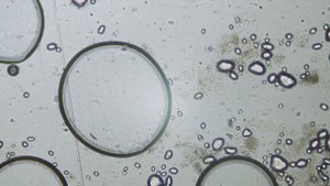 Очередной тест с Крахмалом, тотальное подавление грибка. Seilwurm Labor Berlin slw2022 03 17 00 384