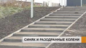 СИНЯК ПОД ГЛАЗОМ И РАЗОДРАННЫЕ КОЛЕНИ.