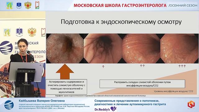 Кайбышева Валерия Олеговна Современные представления о патогенезе, диагностике и лечении аутоиммунно